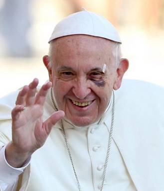Francis_Black_Eye_7.jpg